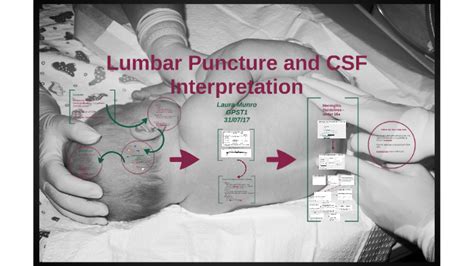 interpretation of results meaning|Lumbar puncture CSF interpretation .